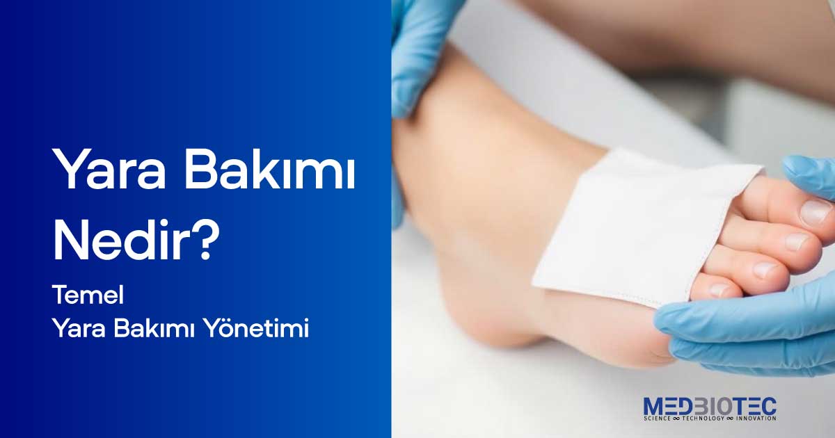Bir hemşirenin mavi koruyucu eldivenlerle hastanın sağ ayağındaki yarayı kolajen ve hyaluronik asit ile dikkatlice tedavi ettiği yüksek çözünürlüklü yakın çekim bir fotoğraf. Yara, steril bir kompres veya bandajla kapatılmış olup, hijyenik ve profesyonel bir tedavi süreci vurgulanıyor. Arka plan, temiz ve aydınlık bir tıbbi ortamı yansıtıyor.