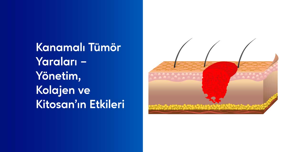 Kanamalı tümör yarasına %60 Tip 1-3 Kolajen + %39 Kitosan içeren hemostatik toz uygulaması. Yara yüzeyinde pıhtılaşma ve iyileşme sürecinin gösterimi.