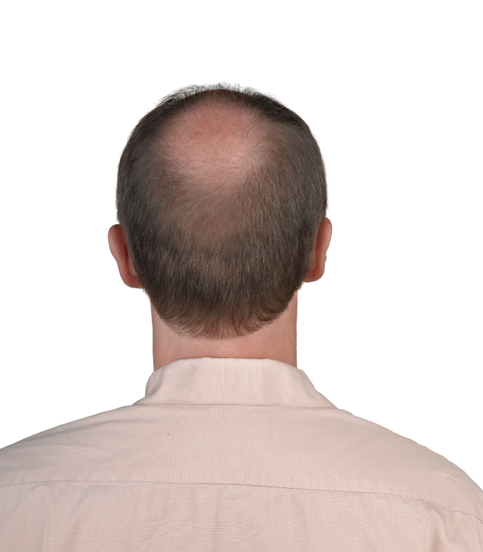 Hair Booster Kolajen Serum - Görsel 3
